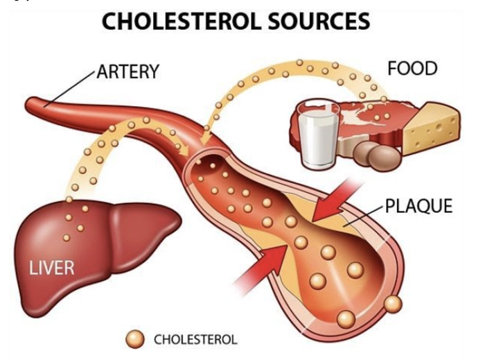 Hiểu đúng Cholesterol toàn phần giúp bạn sống khỏe hơn