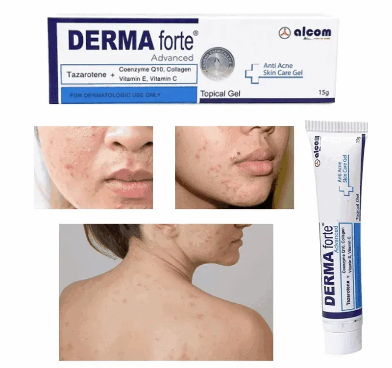 derma forte advanced và derma forte