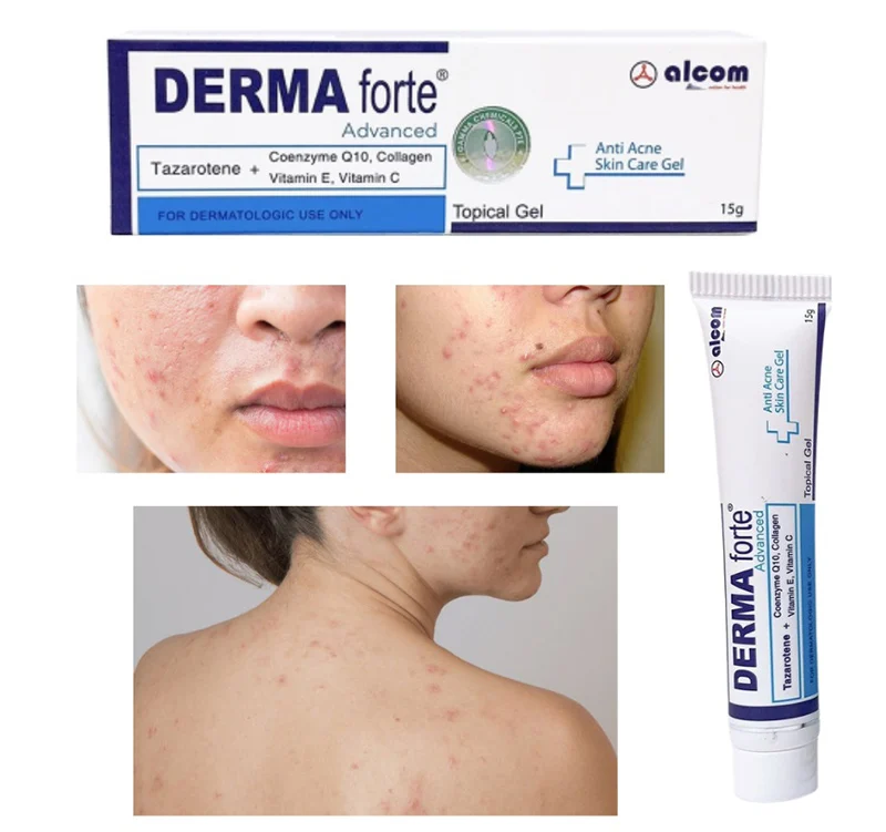 Derma Forte có dùng được cho bà bầu không