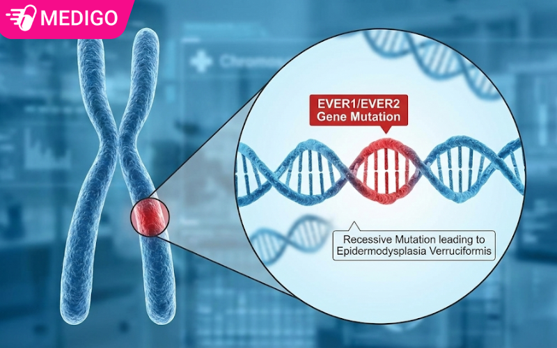 dot-bien-lan-o-cac-gen-ever1-hoac-ever2-tren-nhiem-sac-the