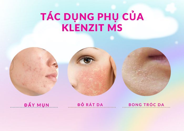 Dùng Klenzit MS bị khô, đỏ, ngứa, rát, tróc da phải làm sao?