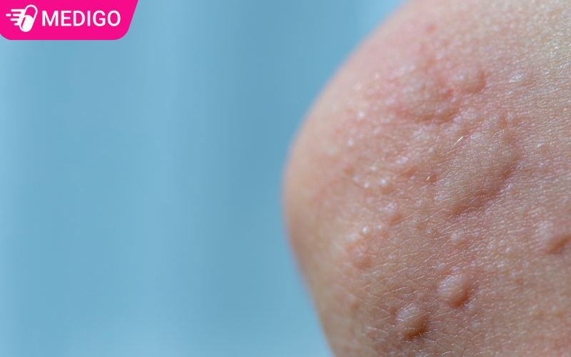 hinh-dang-me-day-tren-da