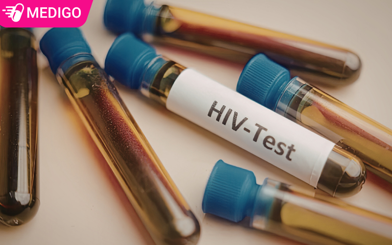 Hieu-ve-Giai-doan-cua-so-trong-xet-nghiem-HIV