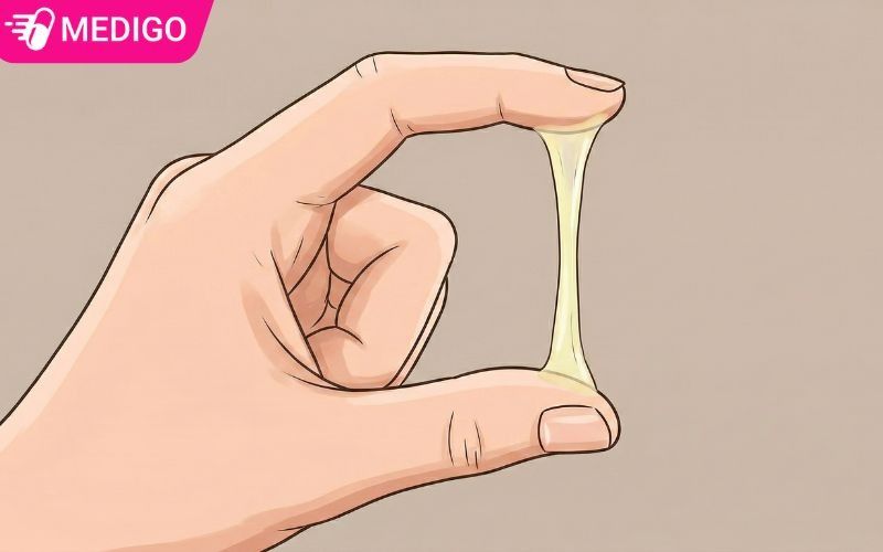 Tinh-trang-khi-hu-mau-vang