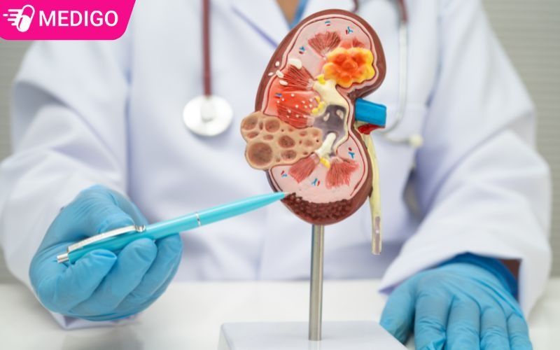 Chuoi-hot-rung-co-the-ho-tro-giam-soi-tiet-nieu-nhu-soi-than