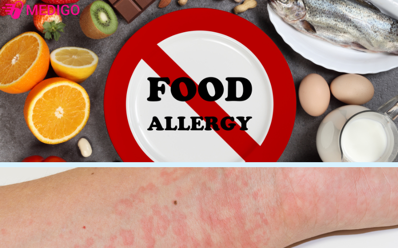 Di-ung-thuc-pham-co-the-la-nguyen-nhan-dan-den-noi-me-day-o-tre