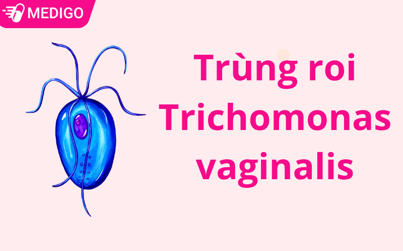 Vi-sao-trung-roi-Trichomonas-lai-lam-khi-hu-co-mau-vang