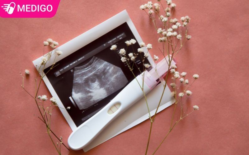 Nhung-yeu-to-lam-tang-nguy-co-mang-thai