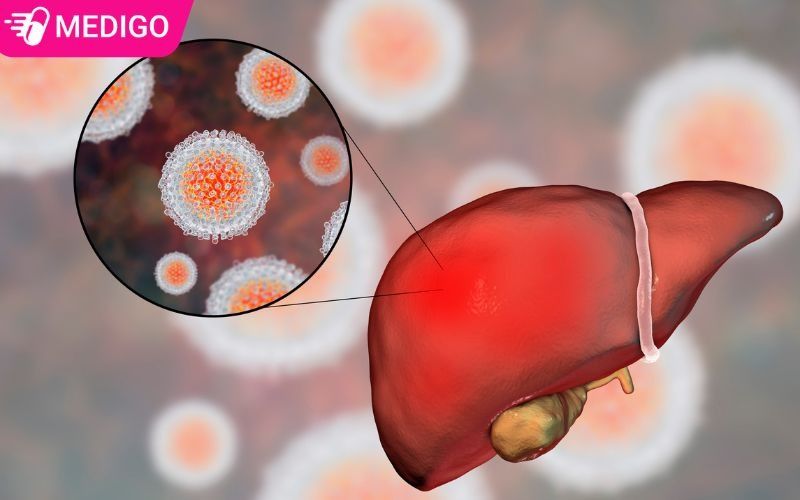 Viem-gan-B-la-mot-trong-nhieu-benh-lay-qua-duong-tinh-duc