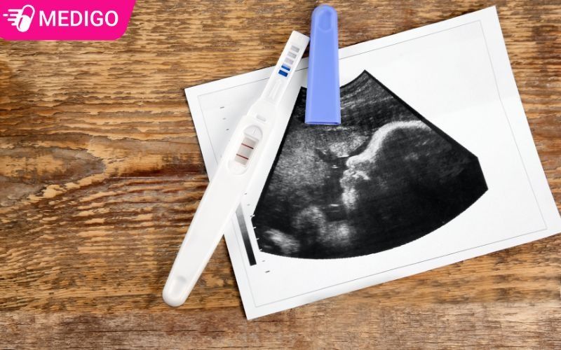 Ty-le-mang-thai-khi-xuat-ngoai