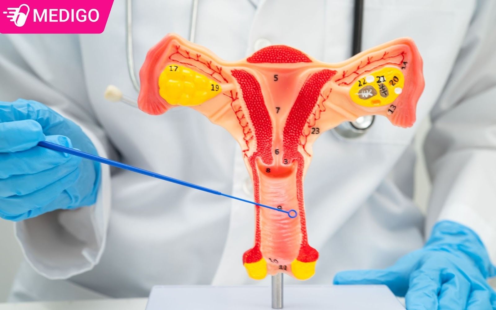 Noi-niem-chi-em-trong-van-de-phu-khoa