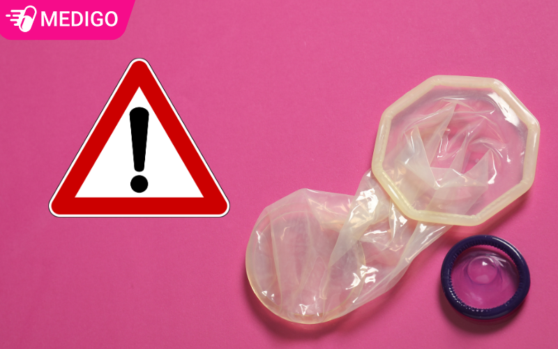 Tai-sao-bao-cao-su-lai-bi-tuot-vao-trong