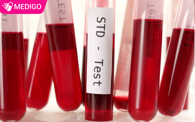 Chan-doan-va-dieu-tri-benh-giang-mai