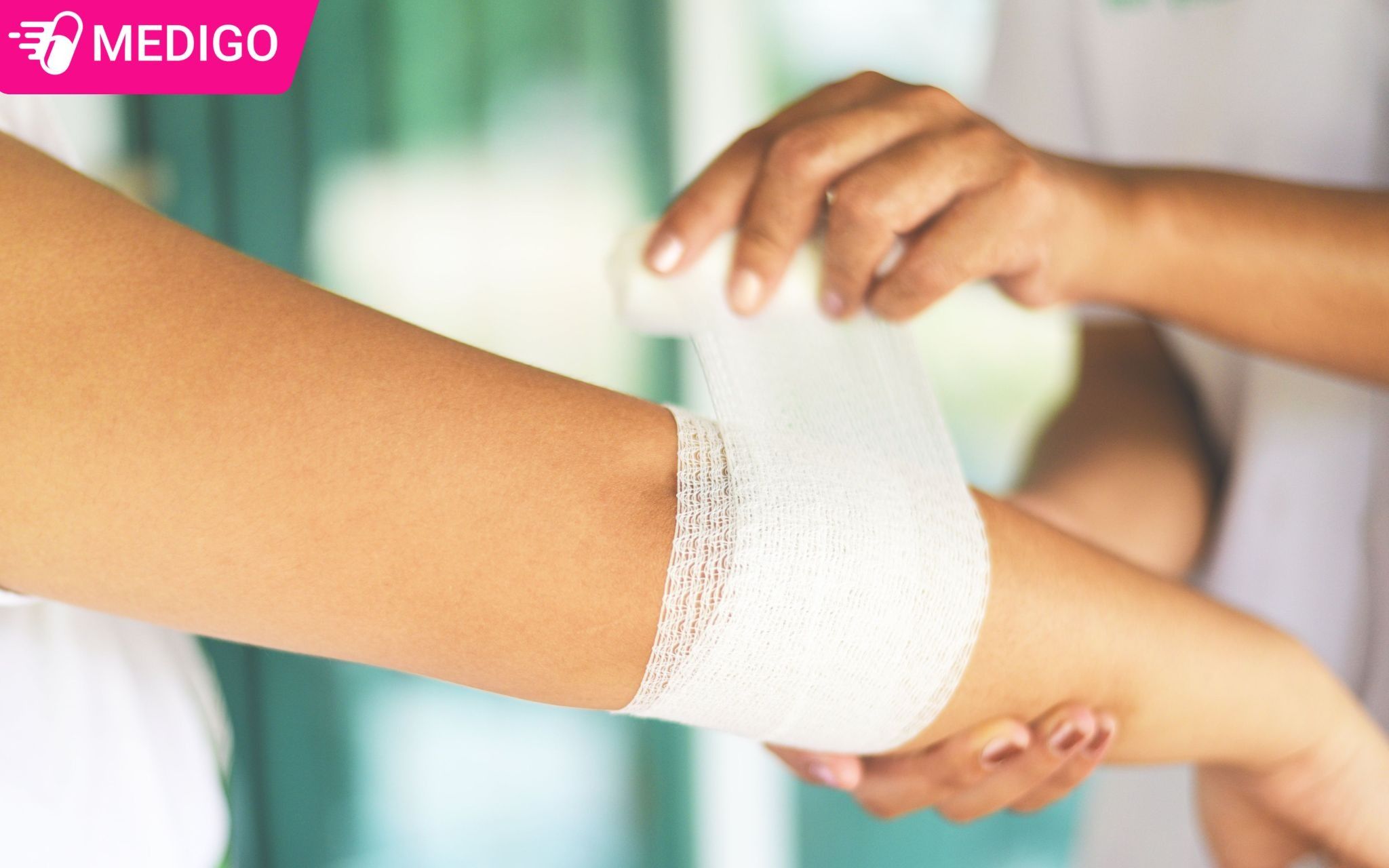 So-cuu-xu-ly-vet-thuong-tray-xuoc-chay-mau-nhe