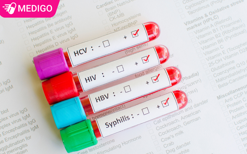 5-dieu-can-biet-ve-nguy-co-HIV-o-nam-gioi