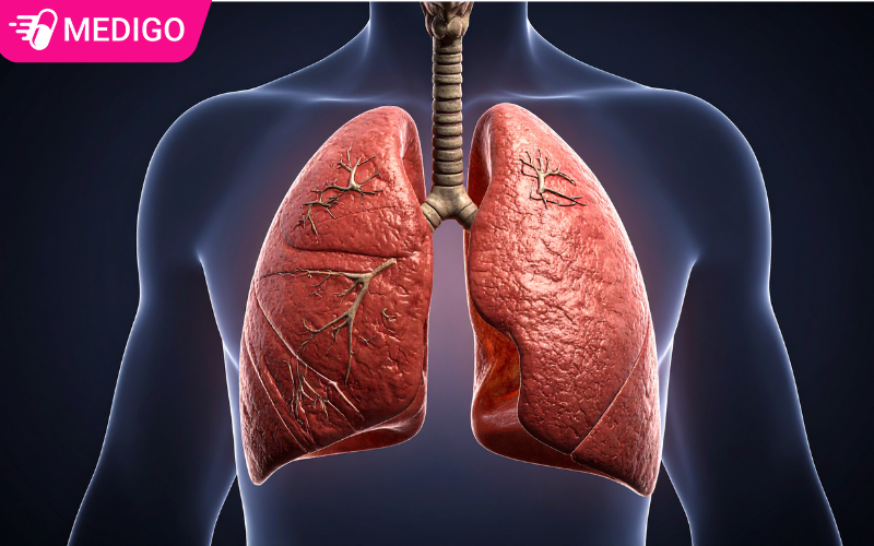 SOLUBOSTON-ho-tro-dieu-tri-hen-phe-quan-viem-mui-di-ung-va-viem-xoang