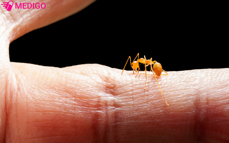 Bi-con-trung-dot-tren-da-dan-den-noi-me-day