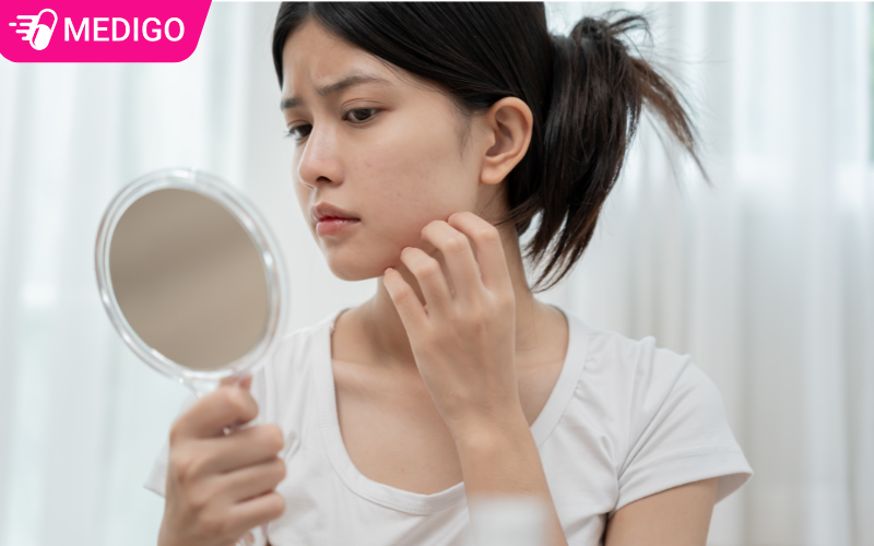 Cay-duoi-chuot-tri-viem-da