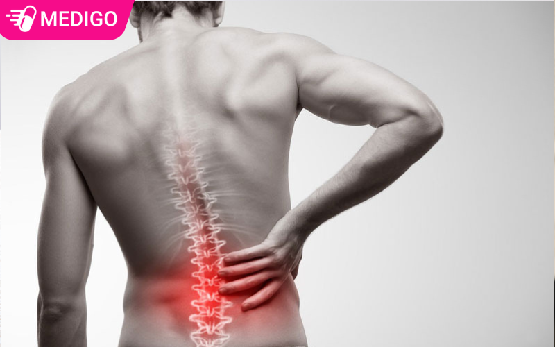 Dau-lung-cap-tinh-gay-co-cung-co-va-han-che-van-dong-trong-sinh-hoat-hang-ngay