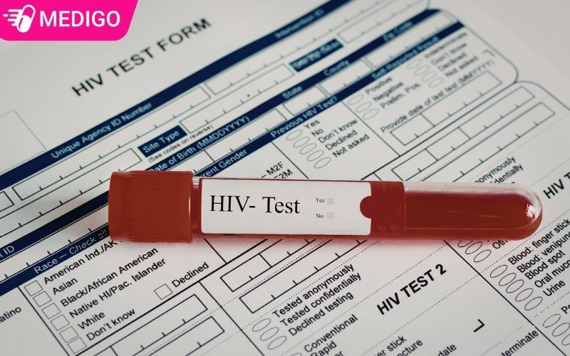 Khi-nao-nen-xet-nghiem-HIV