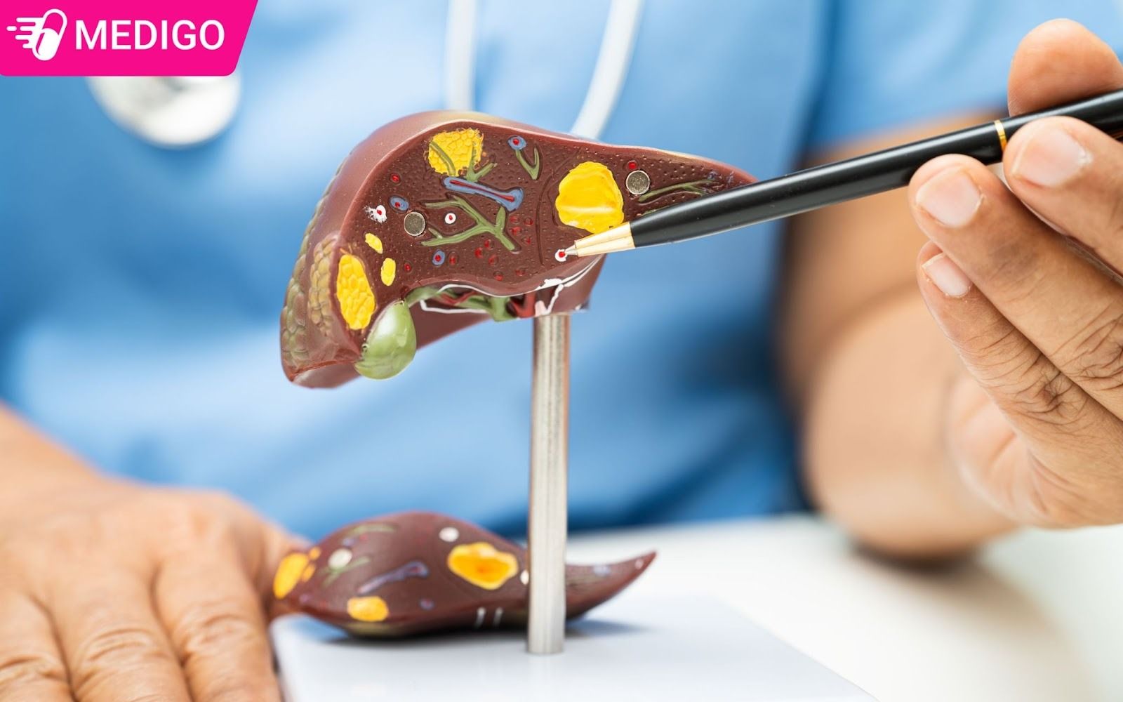 Phu-nu-co-tien-su-bi-benh-gan-nen-luu-y-tham-khao-duoc-si-truoc-khi-su-dung