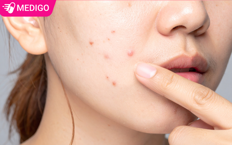 Da-tuoi-20-thuong-gap-van-de-gi