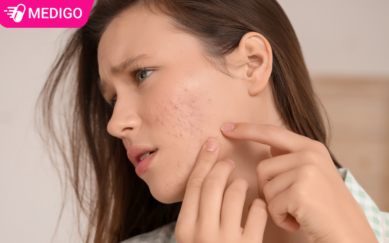 Khong-nan-mun-bua-bai