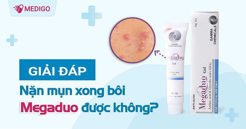 Giải đáp: Nặn mụn xong bôi Megaduo được không?