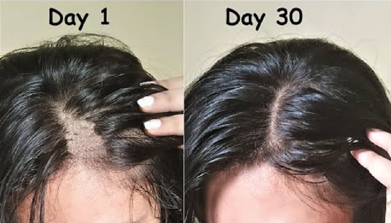 nên uống maxxhair hay biotin