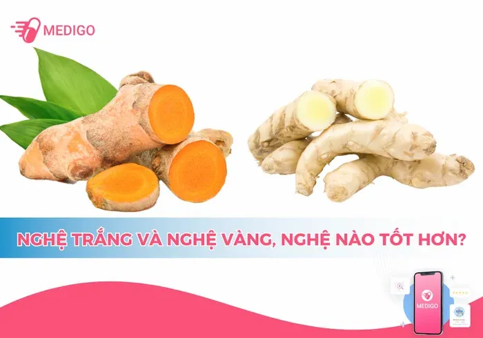 nghệ trắng và nghệ vàng nghệ nào tốt hơn