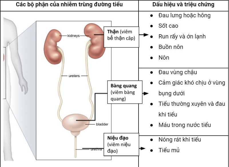 nhiem-trung-duong-tieu.jpg