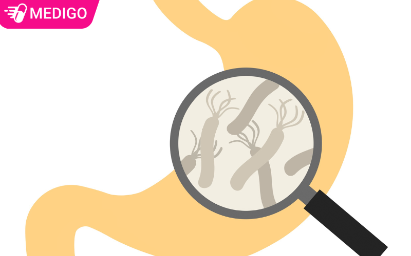 phac-do-dieu-tri-Hp-can-ket-hop-nhieu-loai-khang-sinh