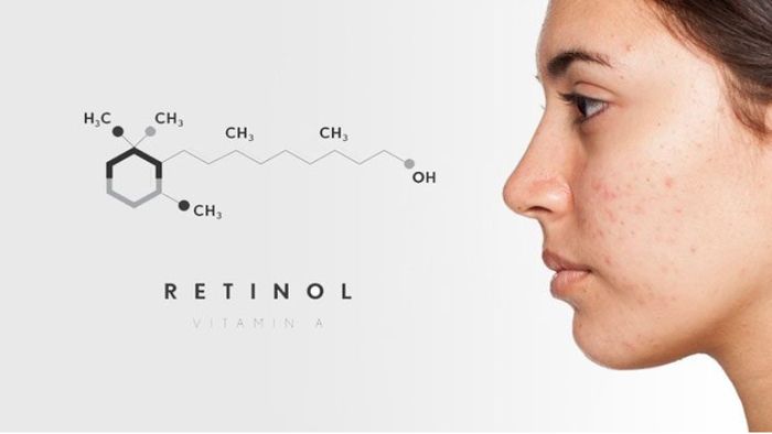 Retinol mua được ở hiệu thuốc không? 