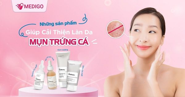 Những sản phẩm giúp cải thiện làn da mụn trứng cá