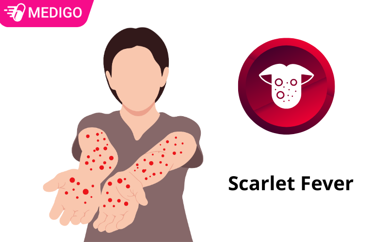 sot-tinh-hong-nhiet-gay-ban-do-va-gai-luoi-sung-do