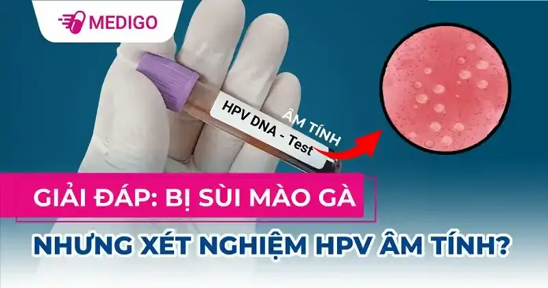 Bị sùi mào gà nhưng xét nghiệm HPV âm tính: Có nên lo ngại?