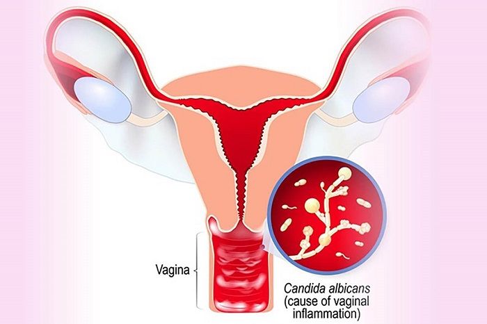 tác hại của thuốc kháng sinh