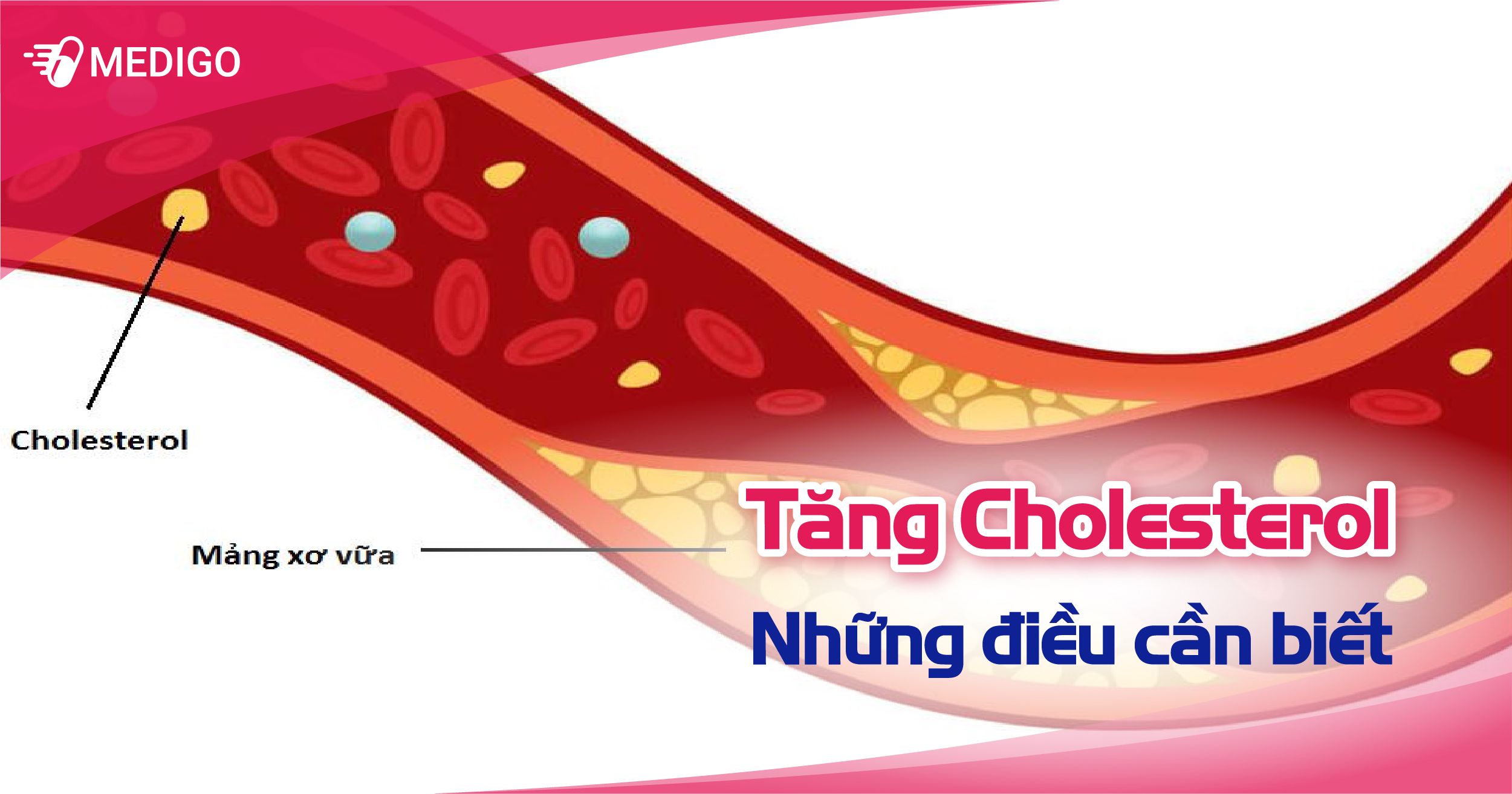 Tăng Cholesterol: Nguyên nhân, biểu hiện, chuẩn đoán và điều trị