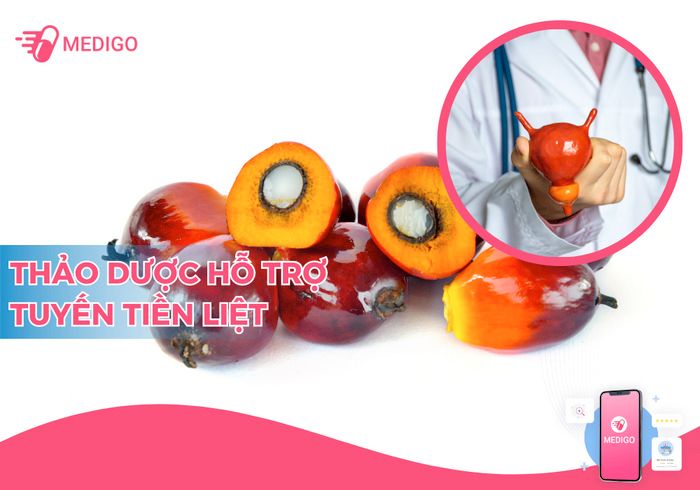 Top 3 thảo dược tốt cho phì đại tuyến tiền liệt