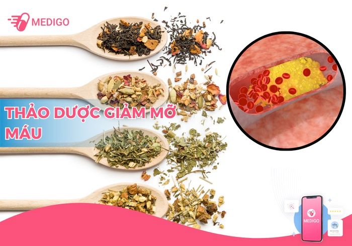 Top 14 thảo dược giảm triglyceride (giảm mỡ máu) hiệu quả