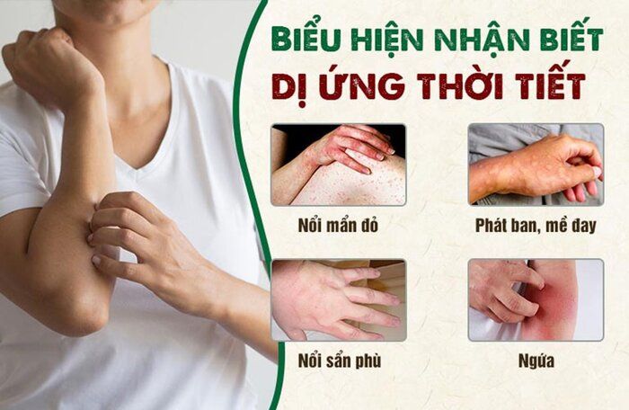 thuốc chống dị ứng thời tiết