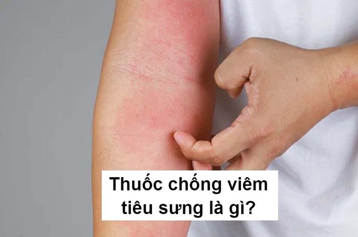 thuốc kháng sinh chống viêm tiêu sưng