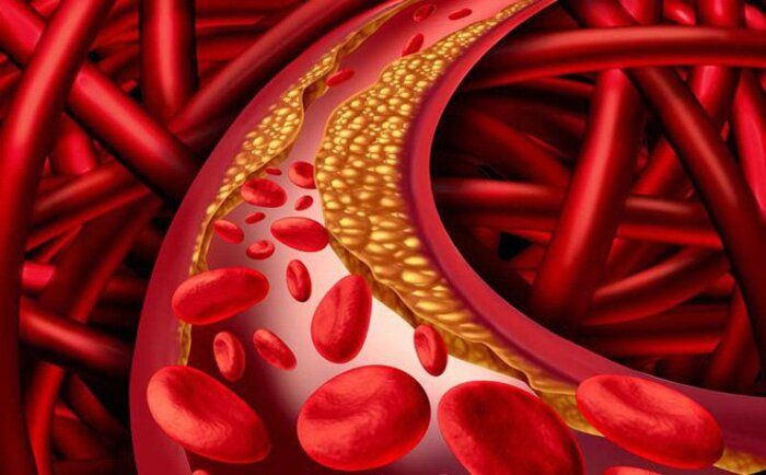 thảo dược nào giảm triglyceride nhanh