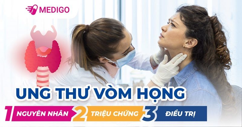 Tổng quan về ung thư vòm họng (Ung thư vòm hầu)