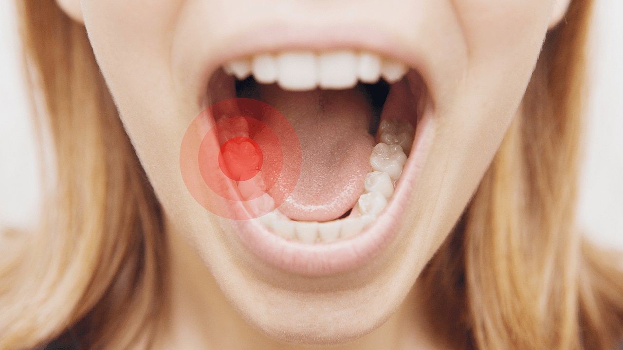 Uống nhiều thuốc giảm đau răng có sao không?