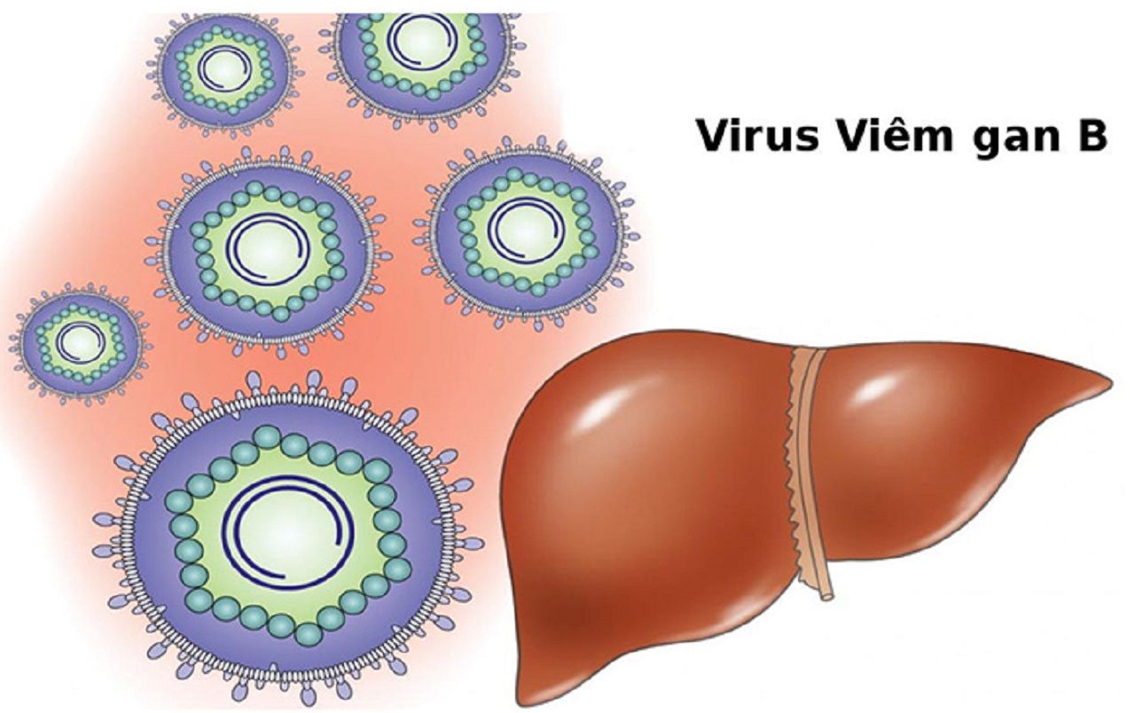 Mắc viêm gan B có bị ung thư gan hay không?