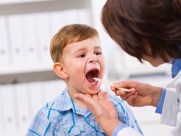 viêm họng hạt ở trẻ em